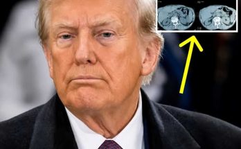 Trump MRI scan results showing cross-sectional medical imaging analysis with four CT scan images displayed