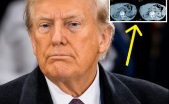 Man in dark suit with medical scan images showing Trump MRI results displayed in upper right corner